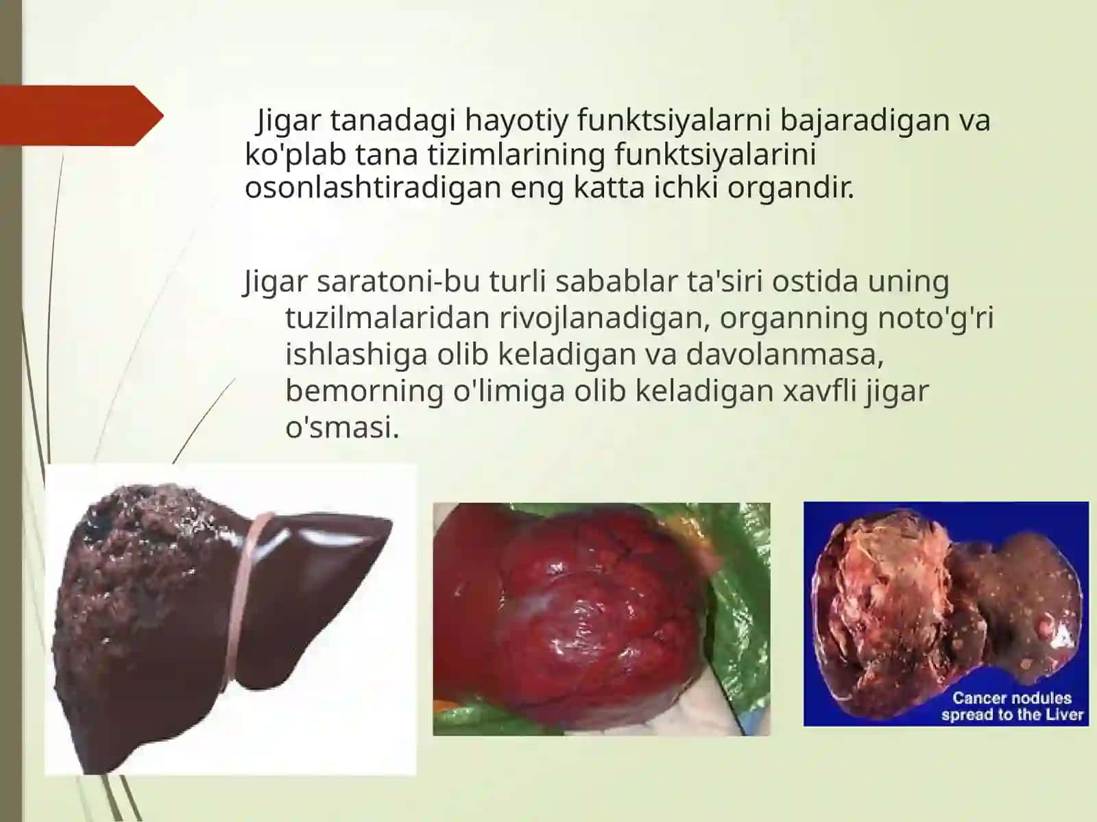 Gepatobilliarjoylashuvio`smasiJigarsaratoni 3