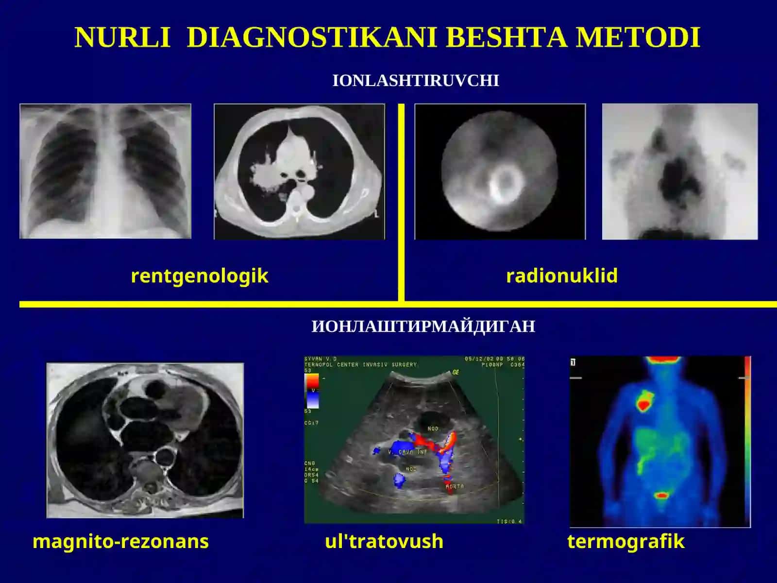 IONLASHTIRUVCHINUR TEKSHIRISH USULLARI 3