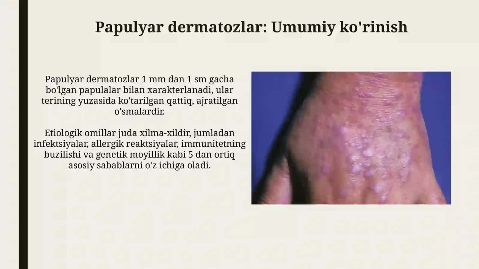 Papulyoz dermatozlar, Psoriaz, Qizil yassi temiratki 3