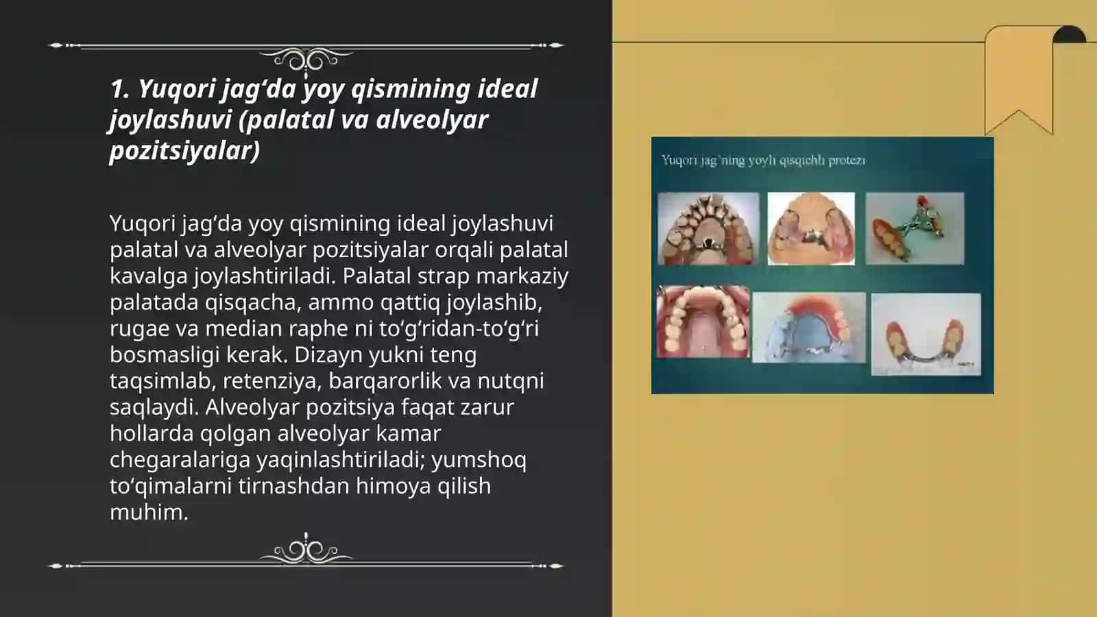 Yuqori va pastki jagʻda yoyli protezlarning yoy qismini joylashuvi 3