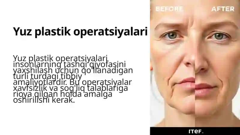 Yuz plastik operatsiyalari 3