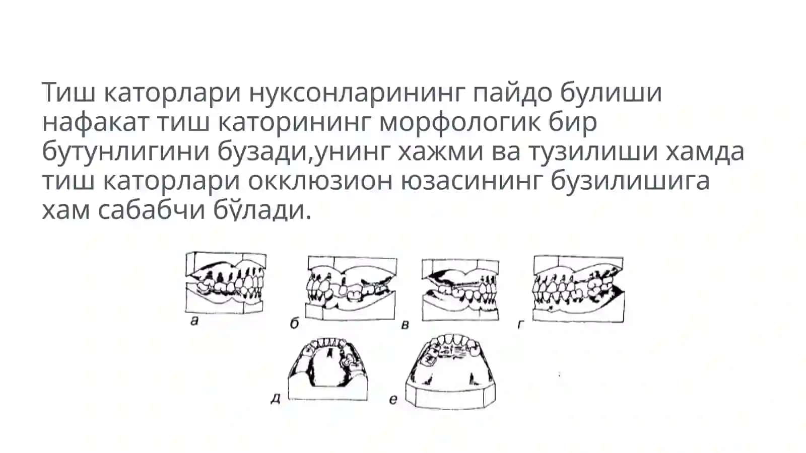Тиш каторлари деформатсияларида окклюзияни шакаллантиришни гнатологик асослари 3