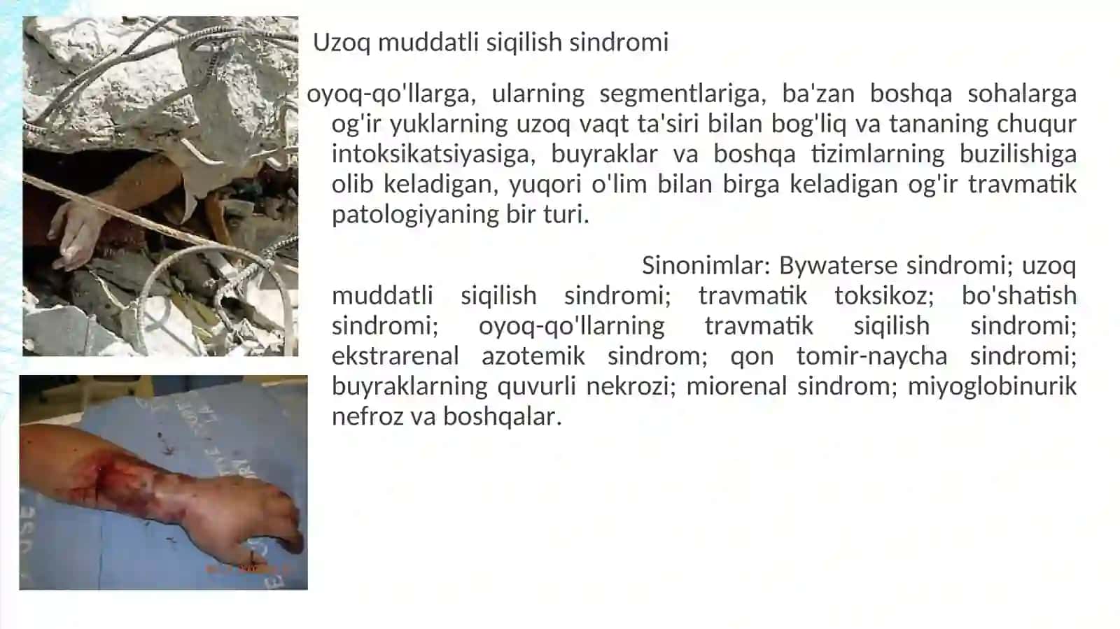 UZOQ EZILISH SINDROMI 3