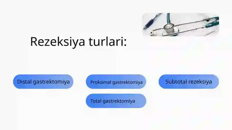Oshqozon rezeksiyasi 3