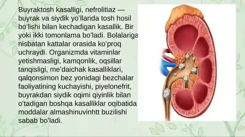 Tosh kasalligining kimyoviy asoslari 3