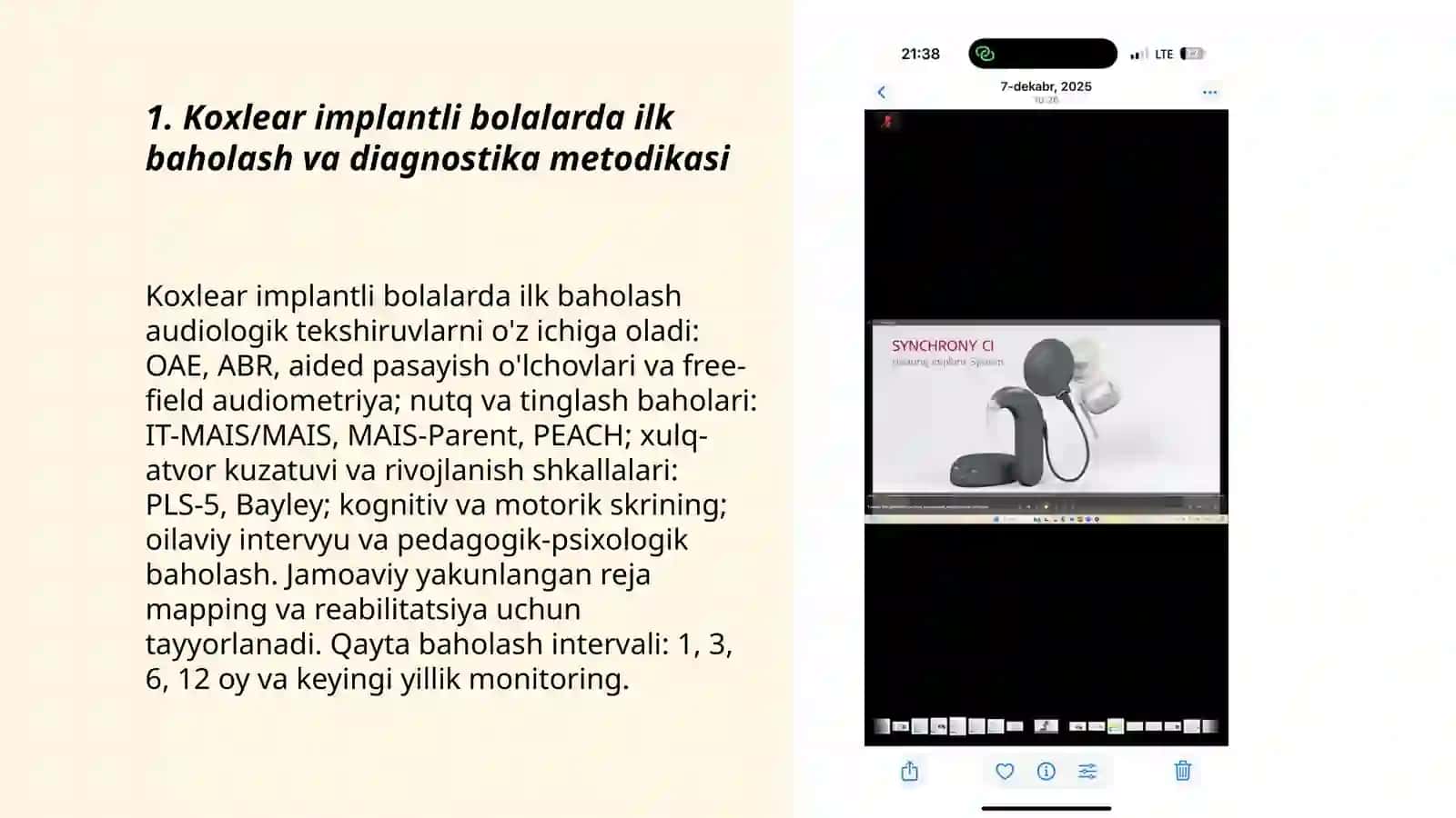 Koxlear implantli bolalarda nutqiy rivojlanish jarayonida pedagogik psixalogik kompleks yondashuv usullari 3