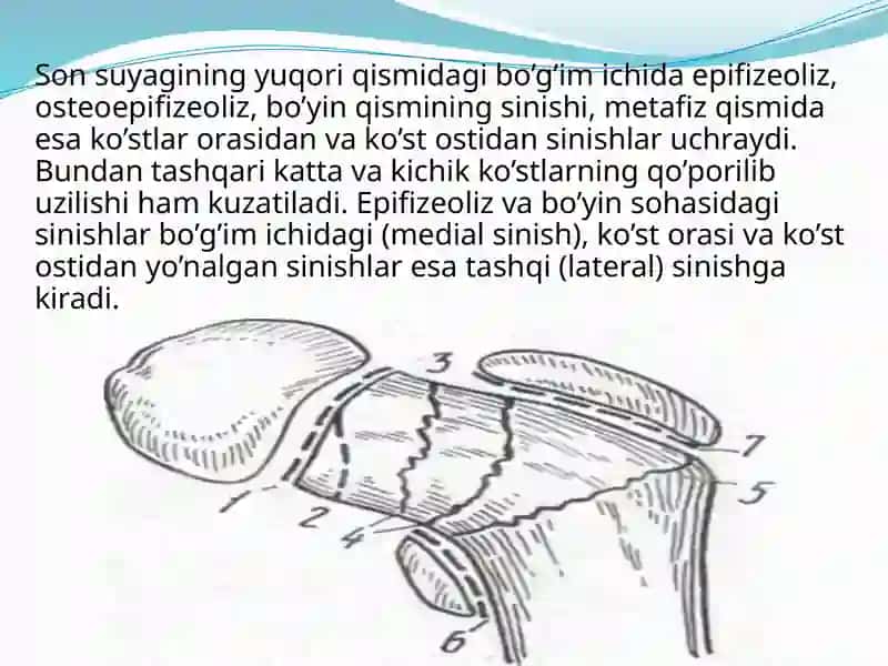 Sonsuyagining sinishlari 3