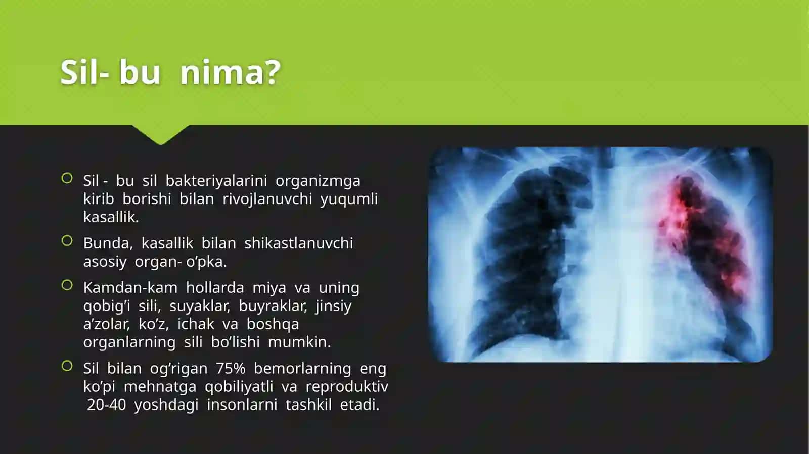 Sil kasalligi va uni oldini olish 3