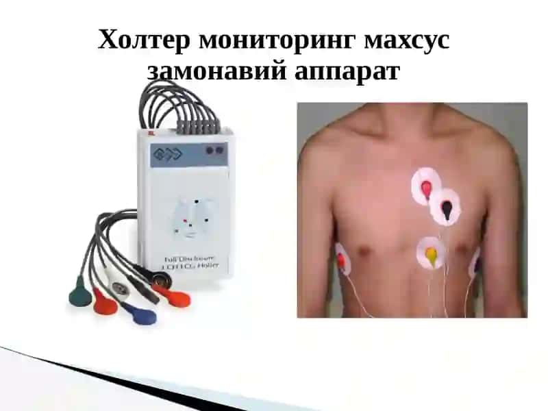 Юрак касалликларини замонавий текшириш усуллари 3