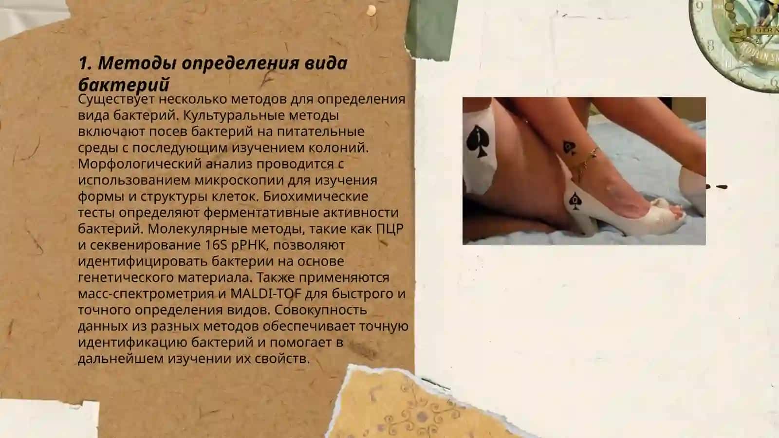 Определение вида бактерий 3