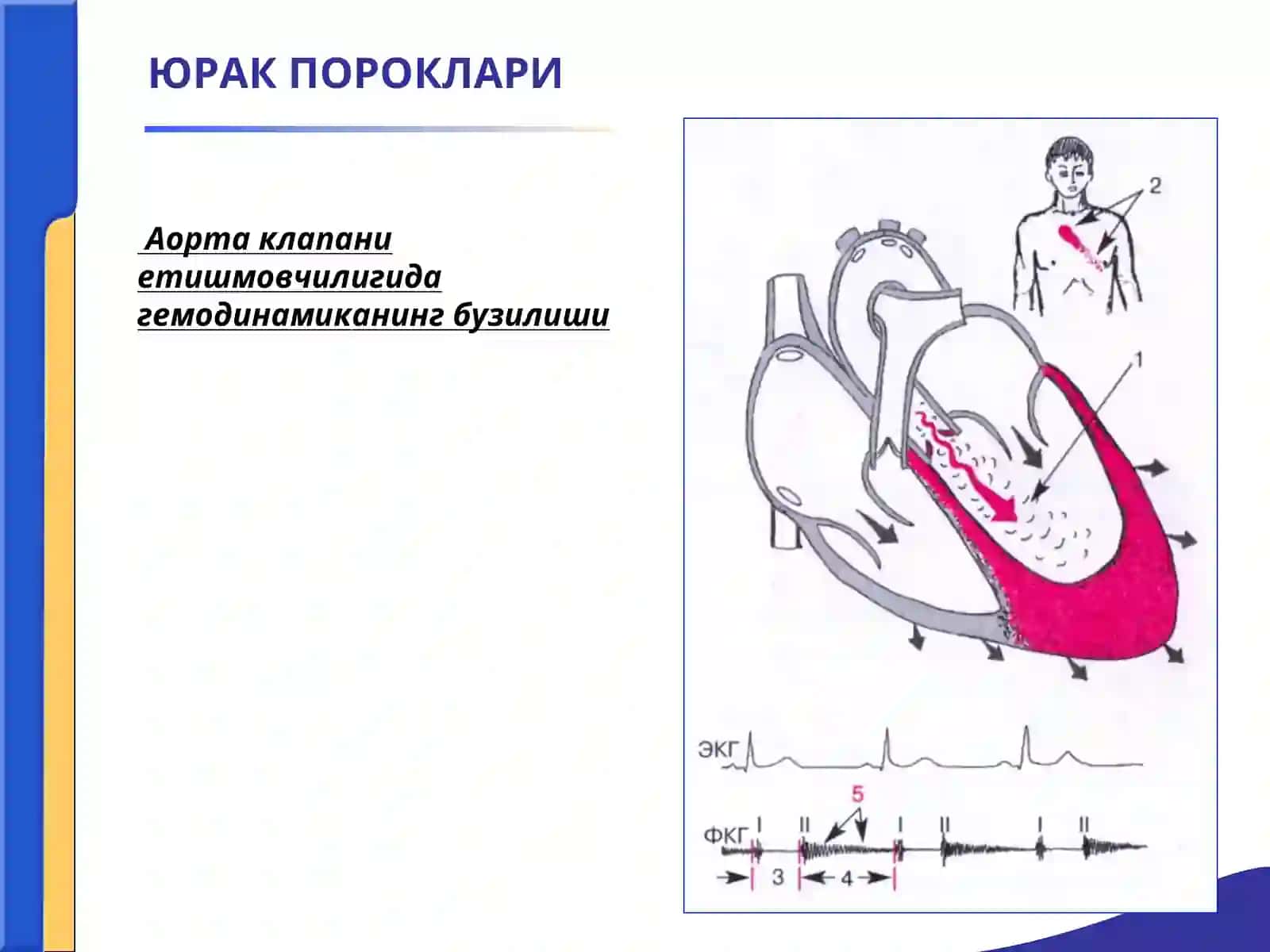 Аортал пороклар 3