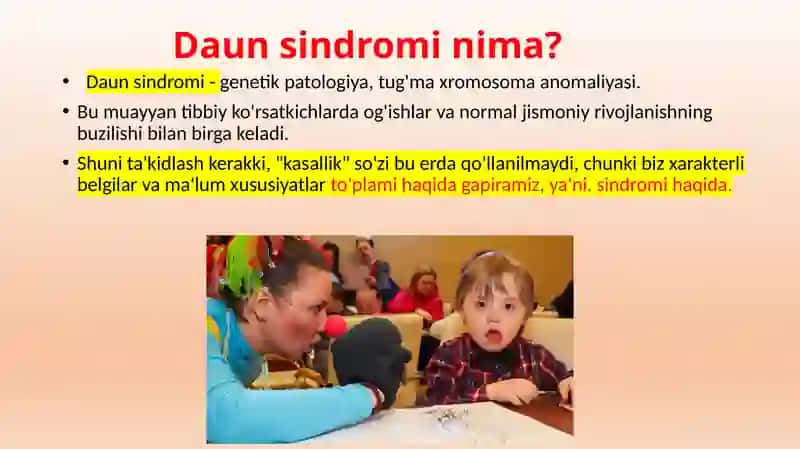 Daun sindromi 3