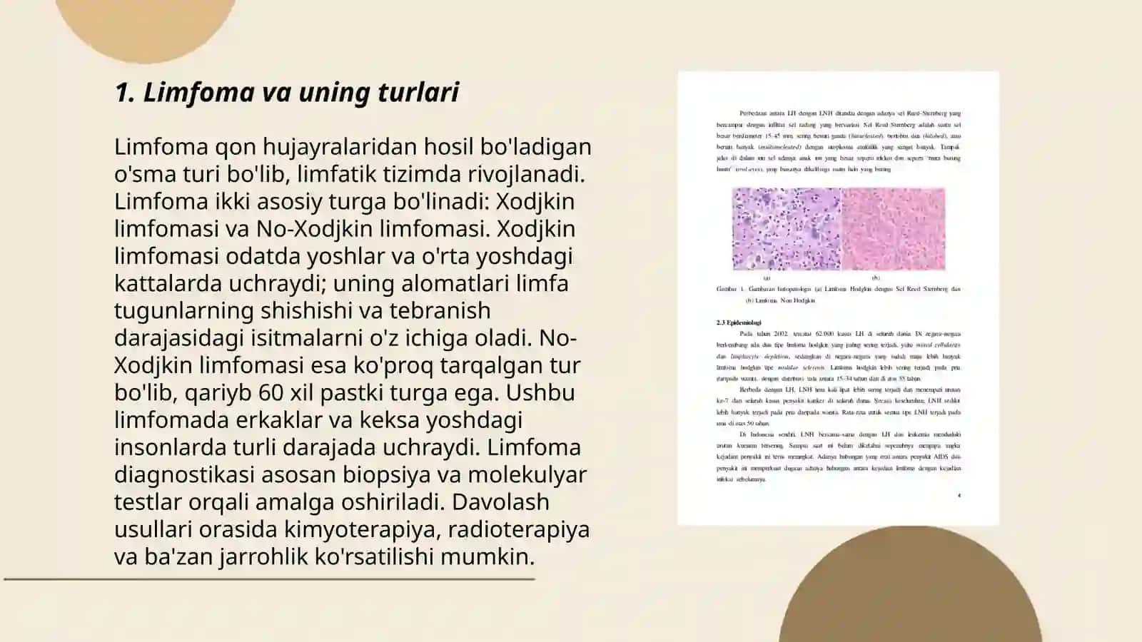 Limfoma va Limfagranulematoz 3