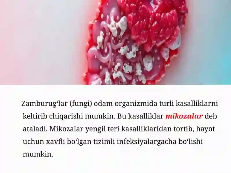 Zamburug’lar keltirib chiqaruvchi kasalliklar 3