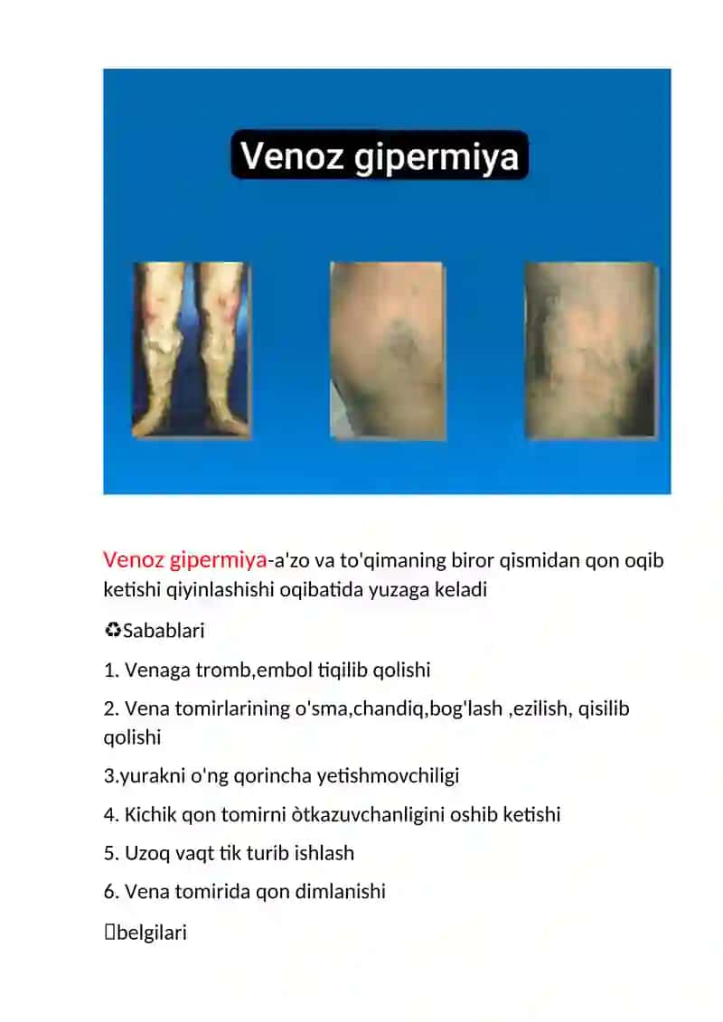 Arterial gipermiya emboliya tromboz ishemiya 3