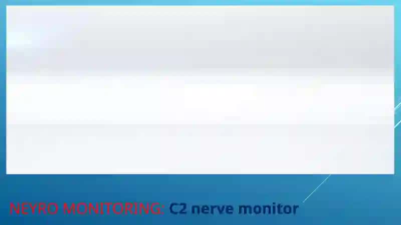 Neyromonitoring 3