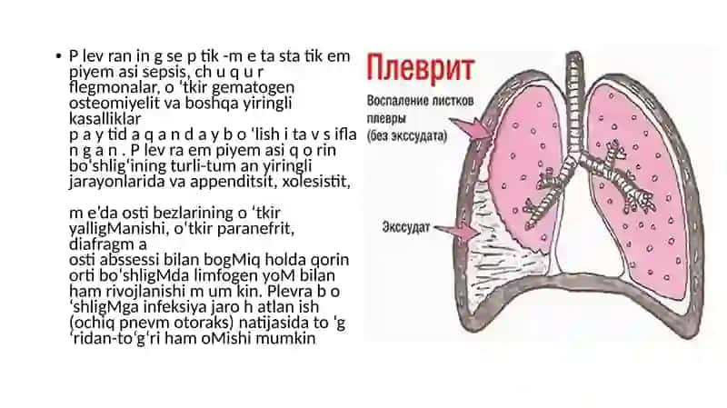 Yiringli plevrit 3
