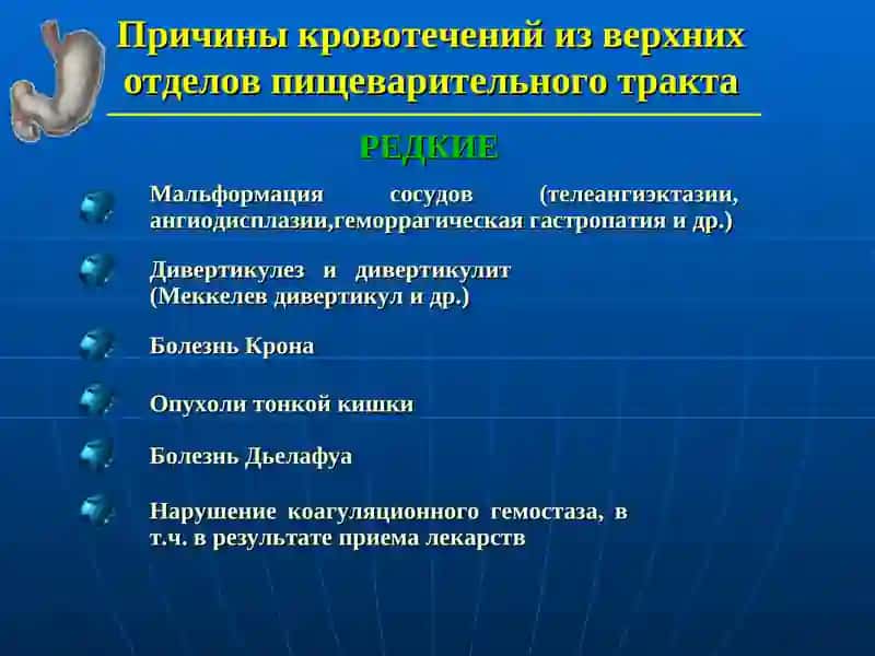Острые желудочно-кишечные кровотечения 3
