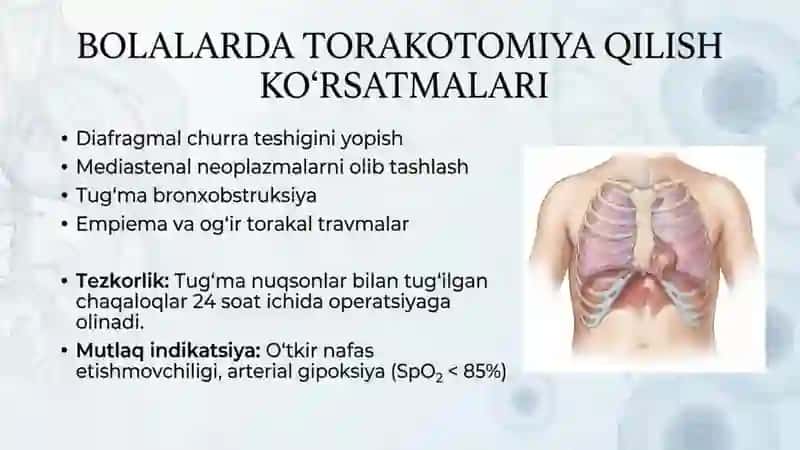 Bolalarda torakotomiya qilish xususiyatlari. Tug'ma va orttirilgan ko'krak qafasi va diafragmani 3