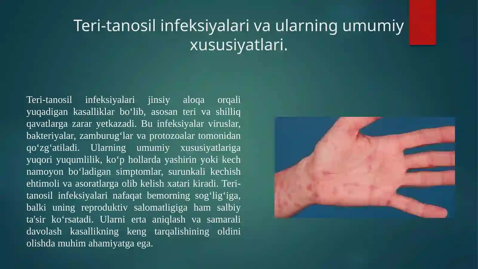 Teri-tanosil infeksiyalari va ularning tavsifi 3