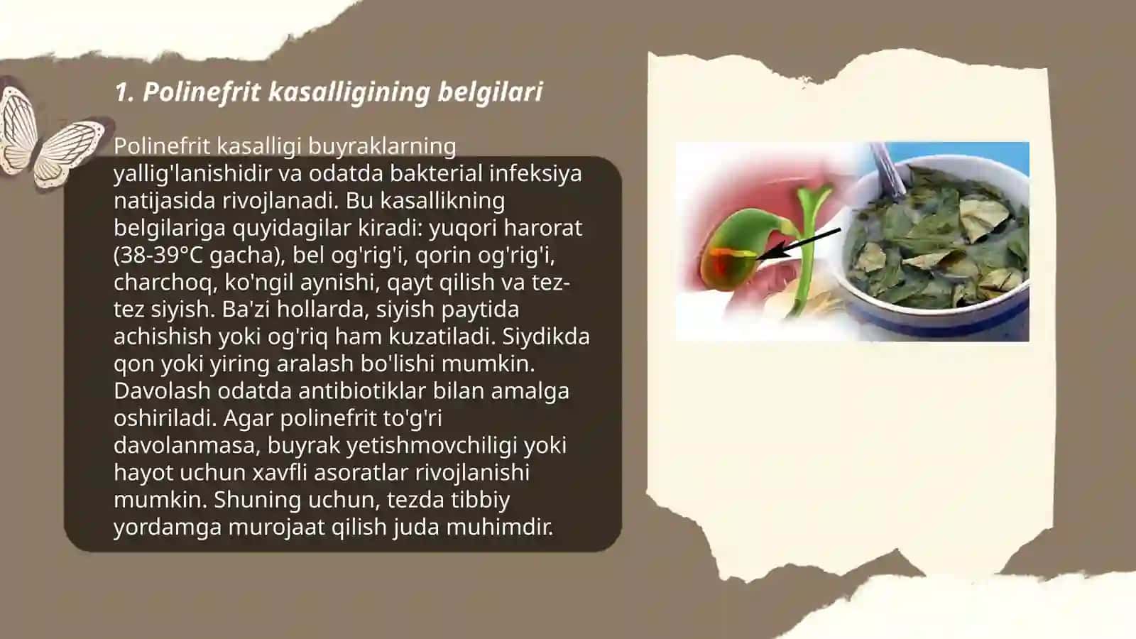 Polinefrit kasaligi sabablari davolash va parvarish qilish 3