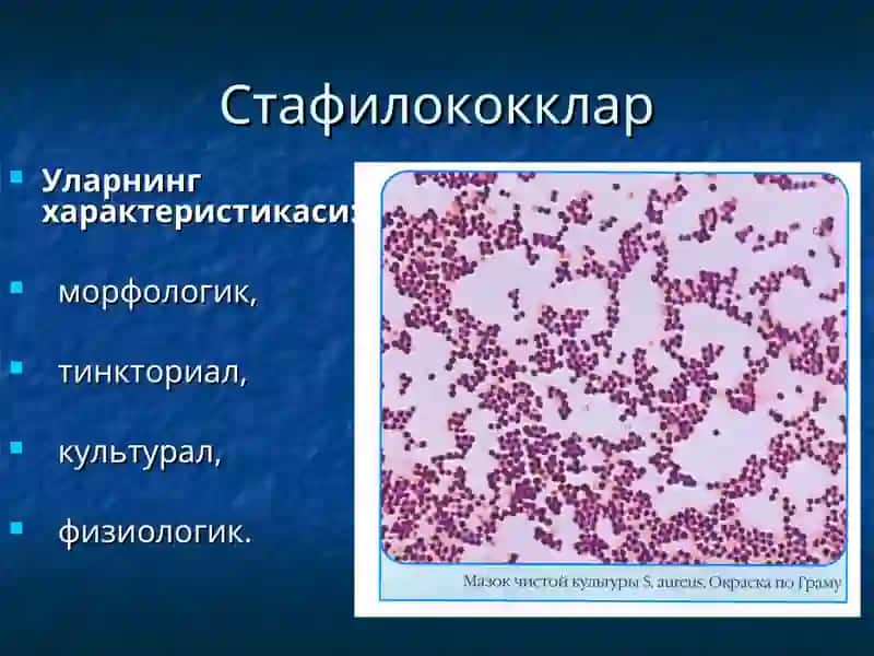 Йирингли яллиғланиш жараёнларини келтириб чиқарувчи микроорганизимлар 3
