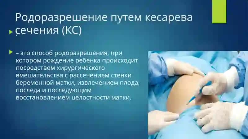 Национальный клинический протокол ПО РОДОРАЗРЕШЕНИЮ ПУТЕМ КЕСАРЕВА СЕЧЕНИЯ 3