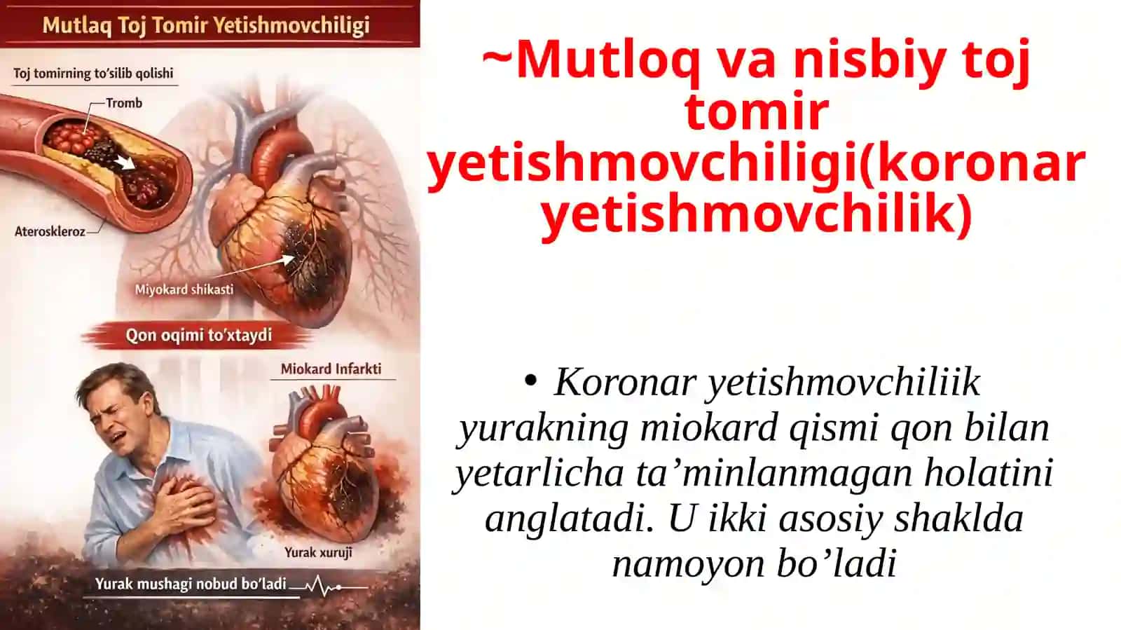 Mutloq vanisbiy toj tomir yetishmovchiligi. Yurak ishemik kasalligi, uning shakllari, sabablari va rivojlanish mexanizmlari 3