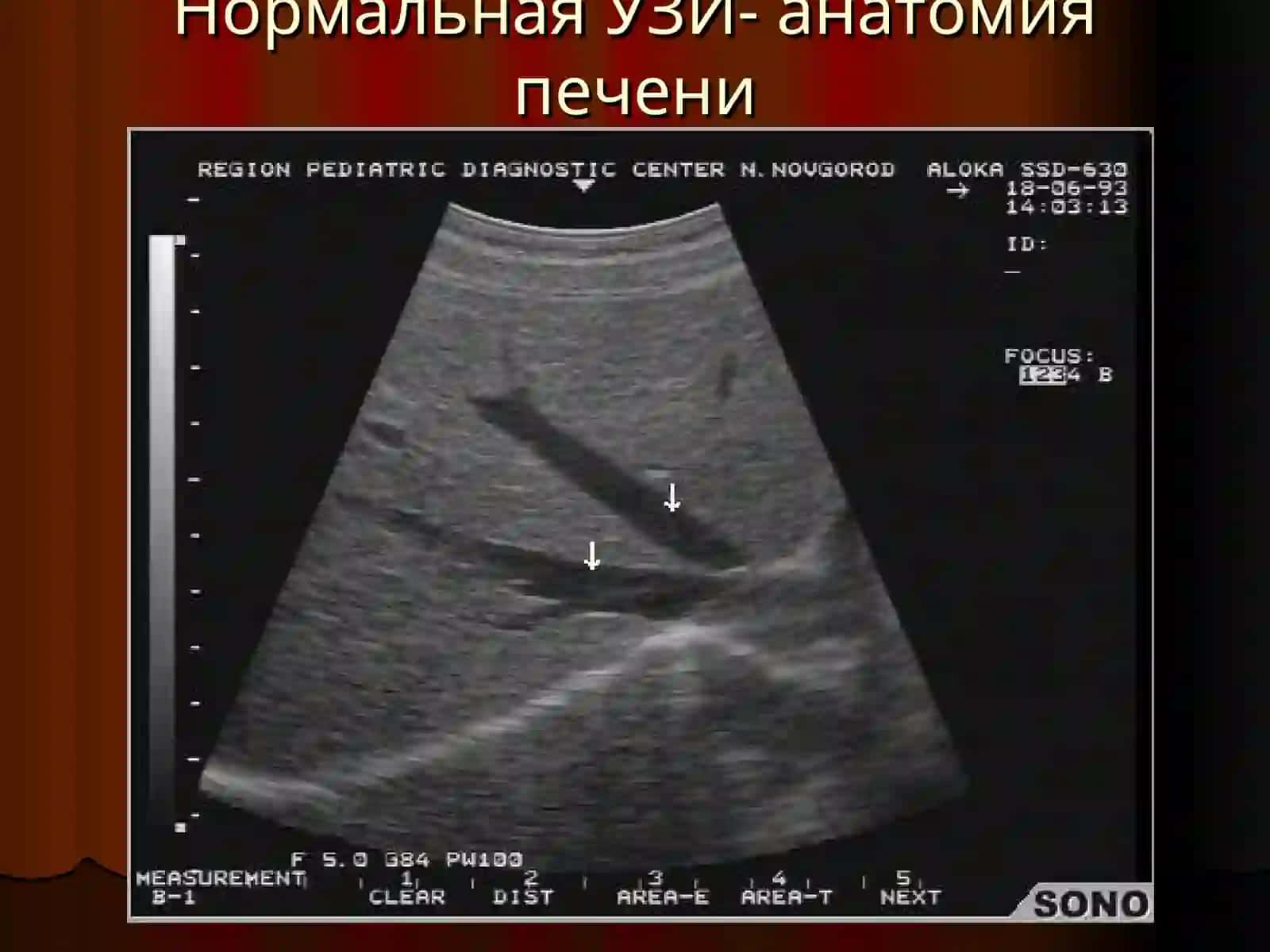 Лучевая диагностика заболеваний печени и желчевыводящих путей 3