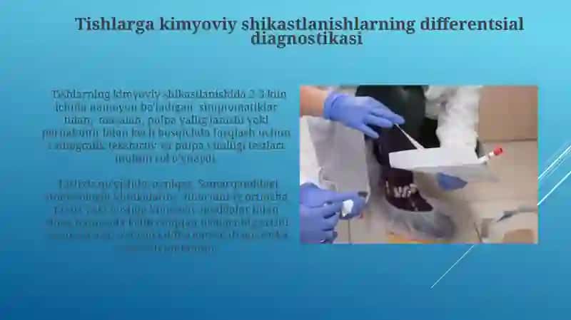 Tishlarni kimyoviy jaroxatlari klinikasi tashxislash va qiyosiy tashxisi 3