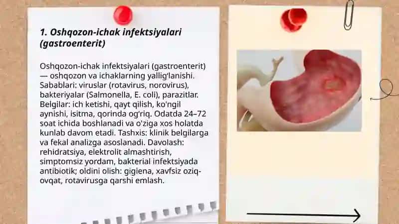 Ovqat hazm qilish tizimi kasalliklar 3
