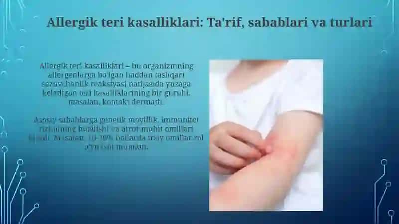 Terining allergik kasalliklari 3