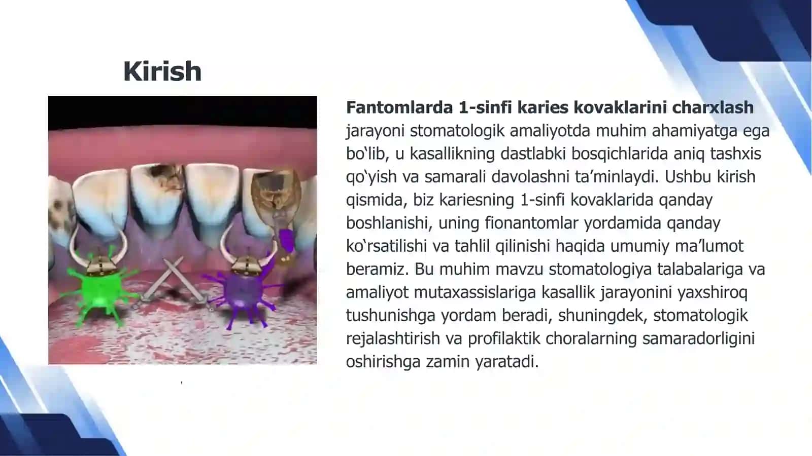 Fantomlarda 1-sinf Karies kovaklarini charxlash 3