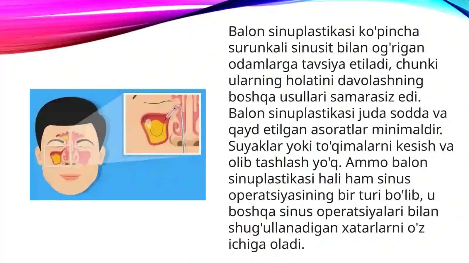 BALLOON SINUPLASTIKA 3
