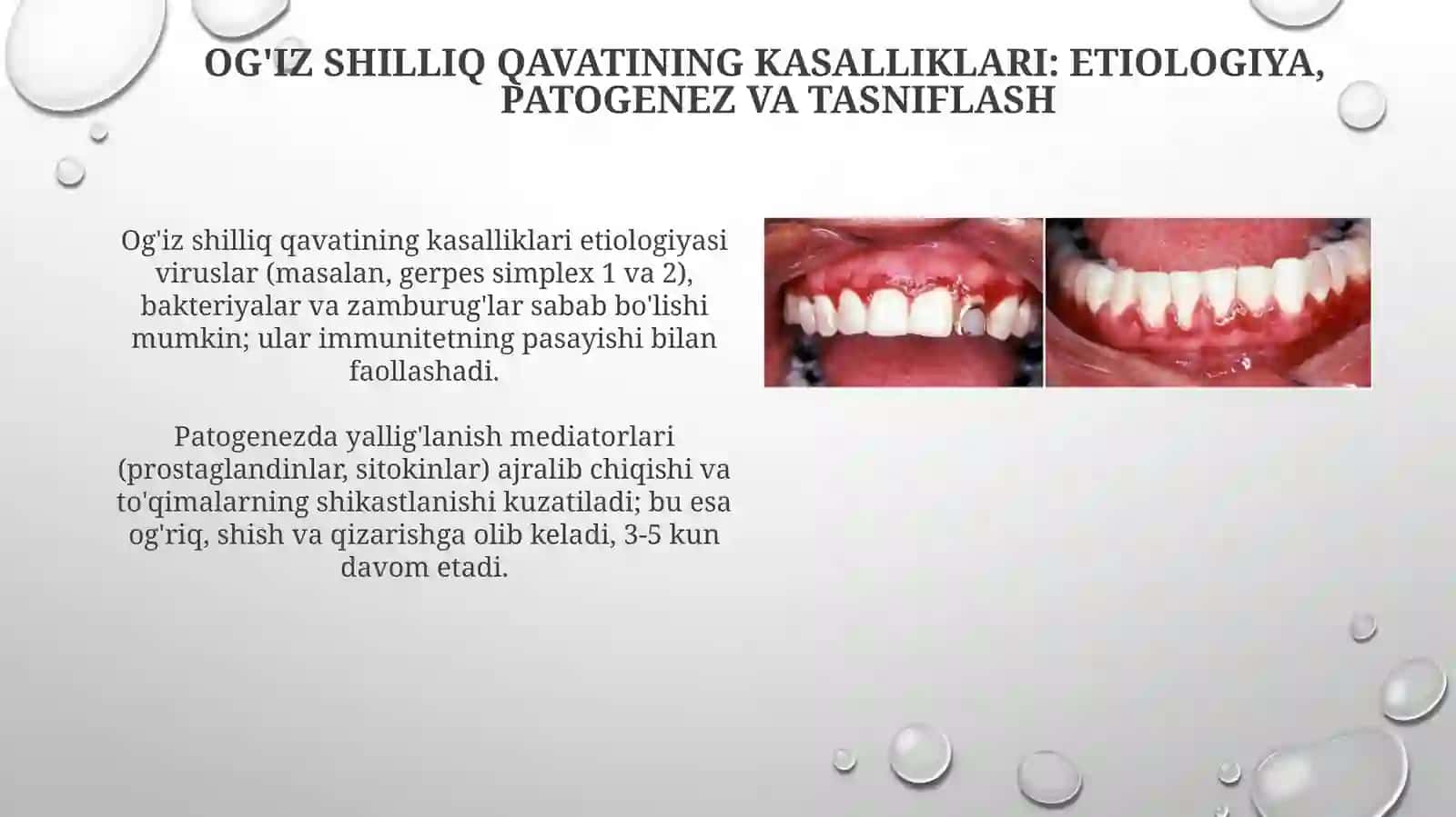 Og'iz shilliq qavati va yuz jag’ yallig’lanishi kasalliklari 3