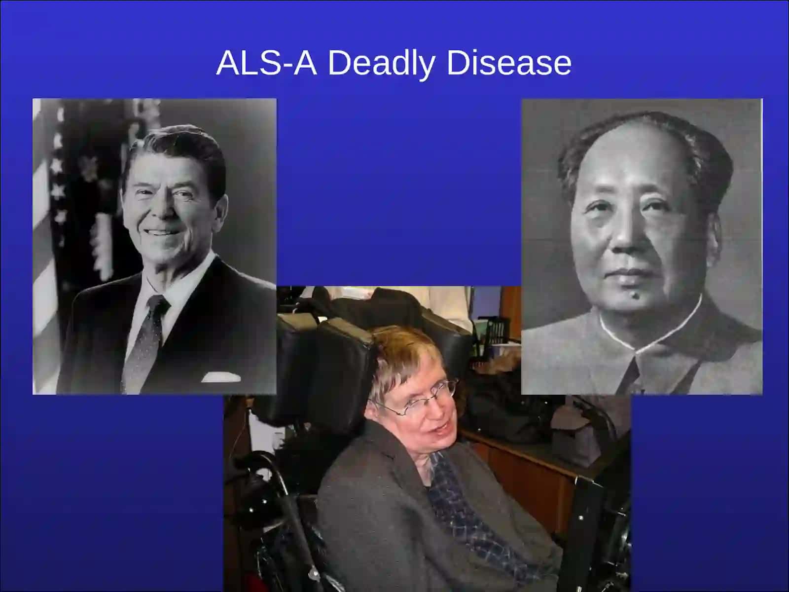 Amyotrophic Lateral Sclerosis 3