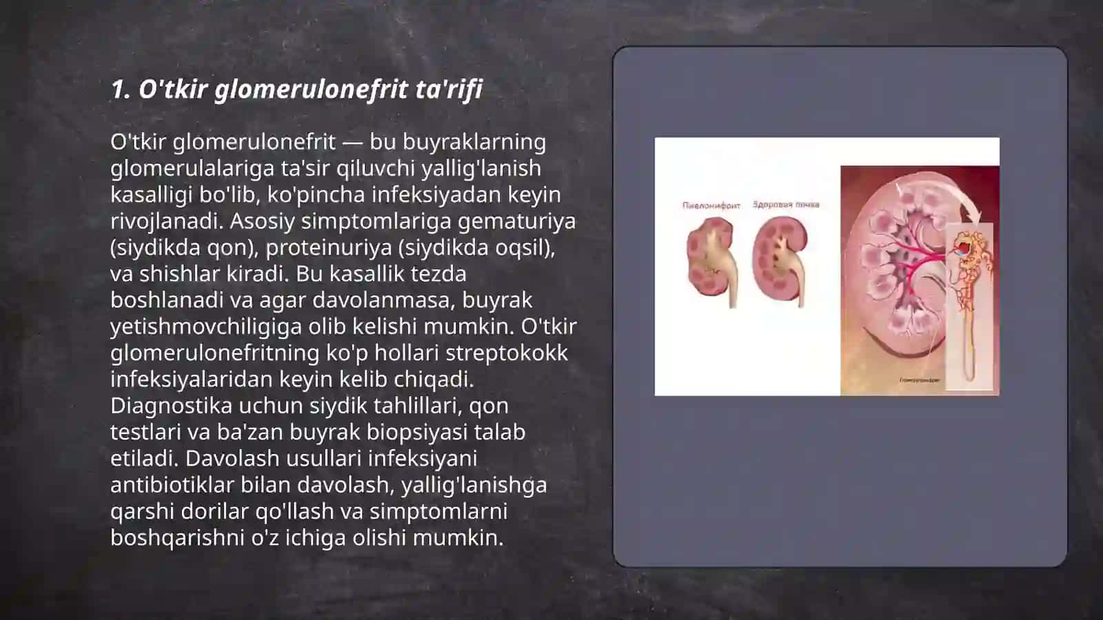 O'tkir Glomerulonefrit 3