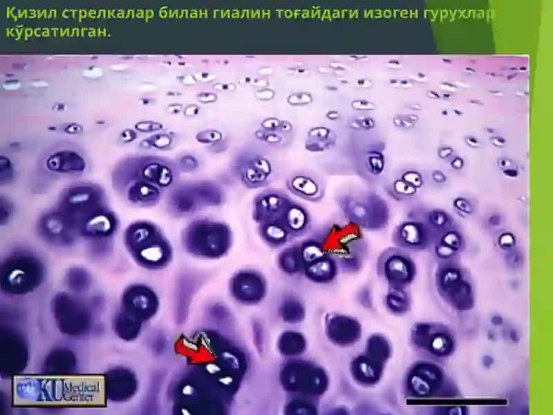 Гиалинтоғайи 3