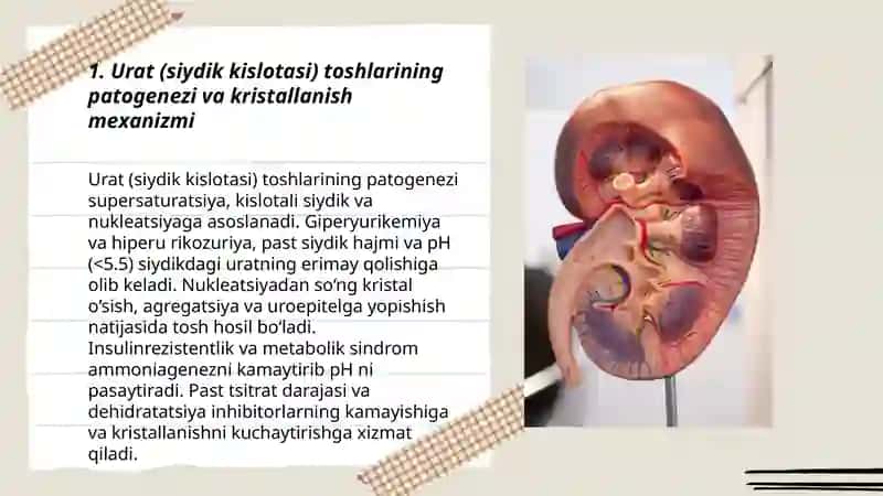 Urat toshlarining hosil bo'lishi va davolash yo'llari 3