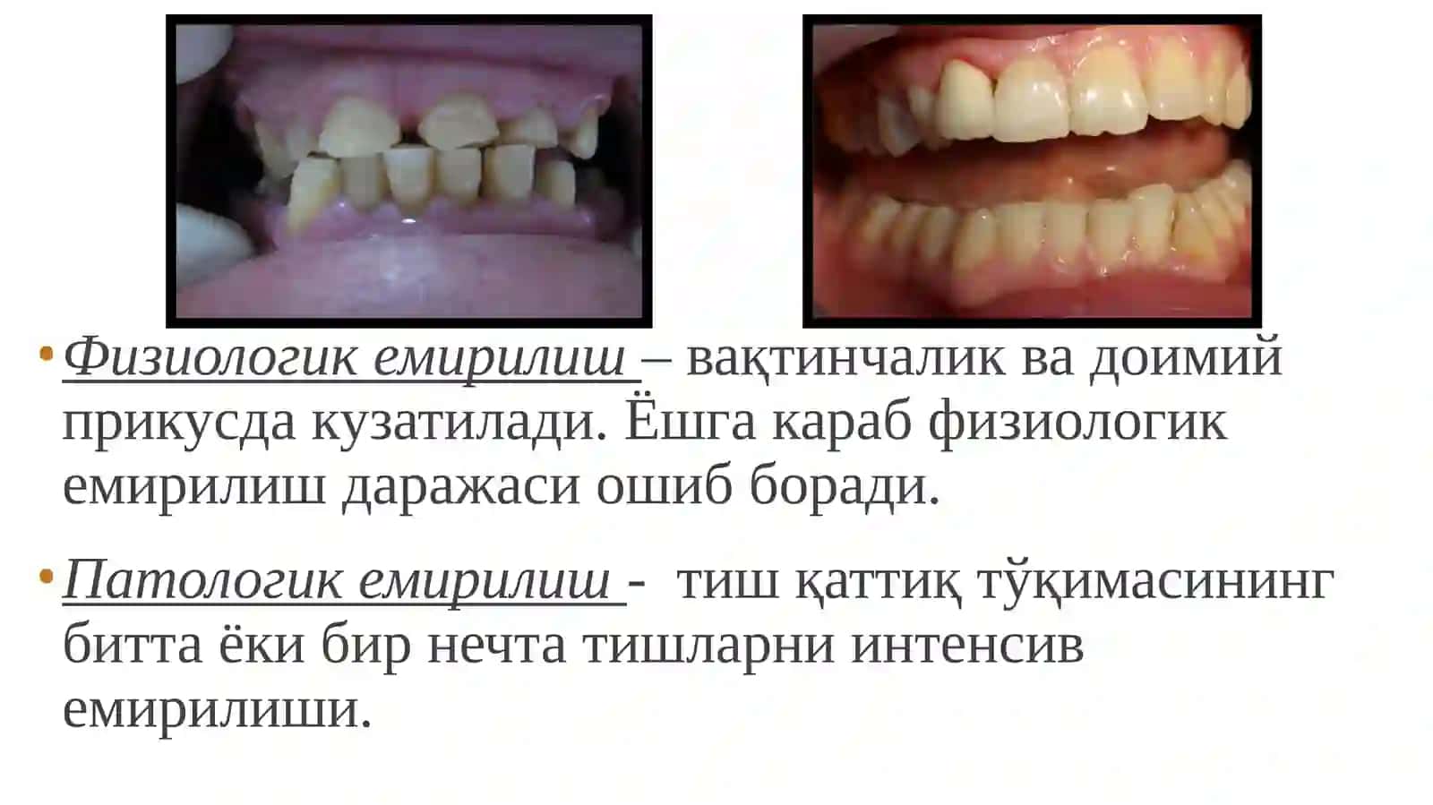Tish chiqqandan keyin paydo bóladigan nokariyes kasalliklar. Tish qattiq tóqimasi nekrozi 3