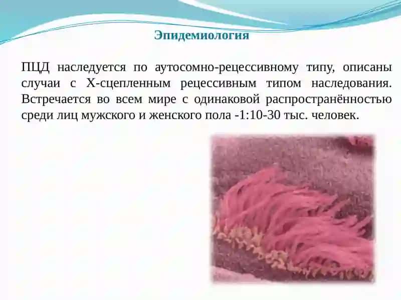 Картагенер синдроми 3