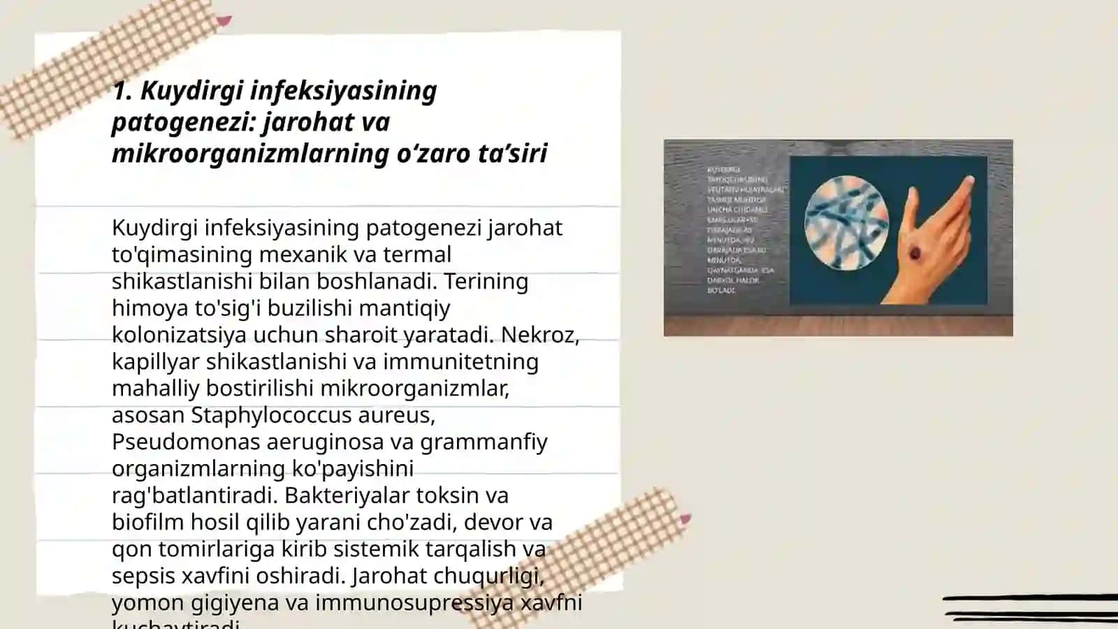 Kuydirgi infeksiyasining patogenezi 3