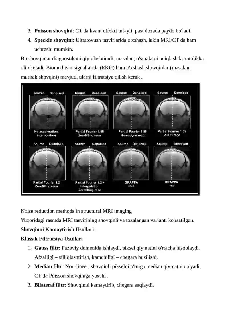 Tibbiy tasvirlarda shovqinni kamaytirish va enhancement usullari 3