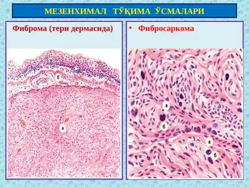 Мезенхима 3