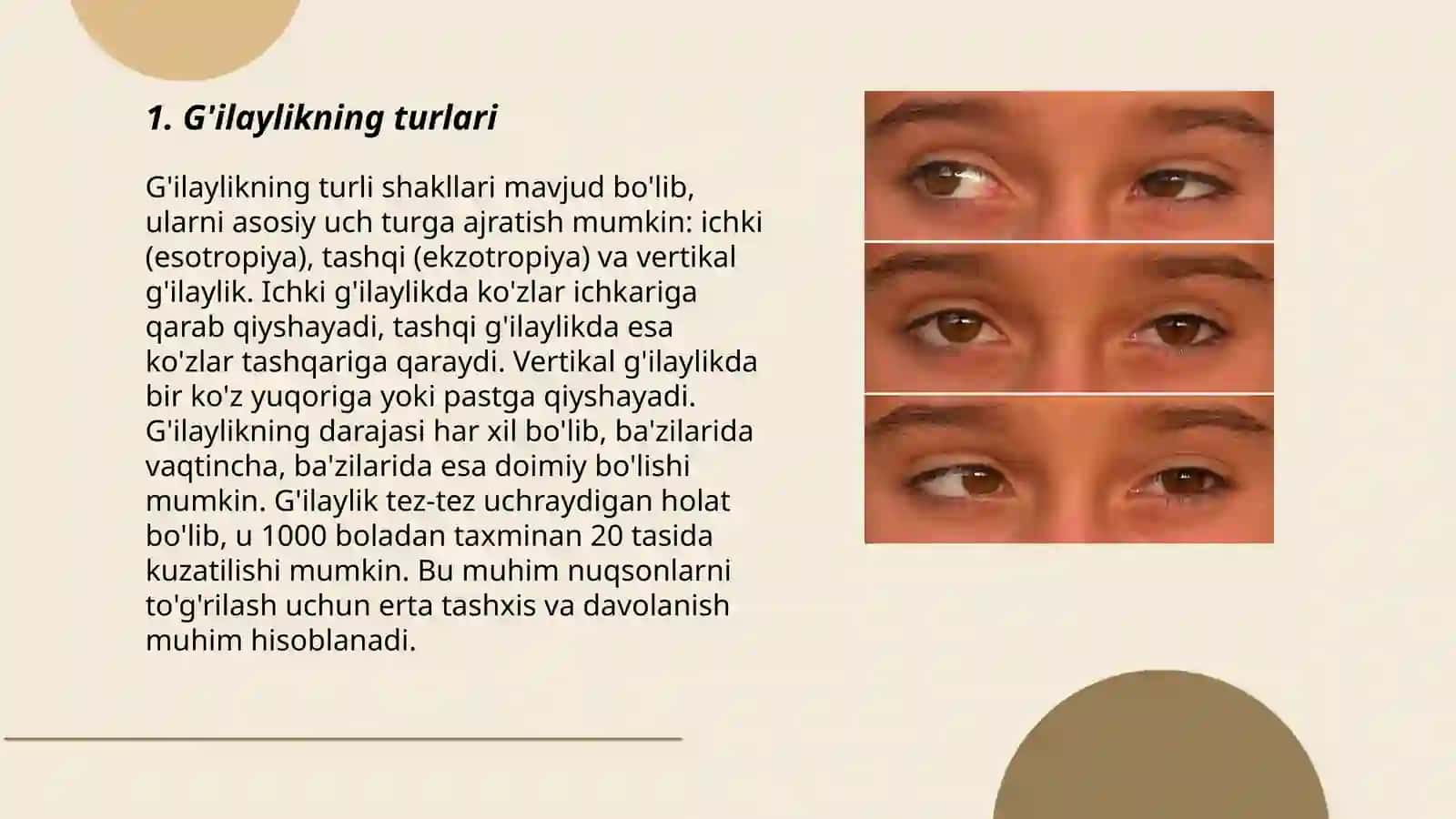 Oftalmologiyada G'ilayliklar 3