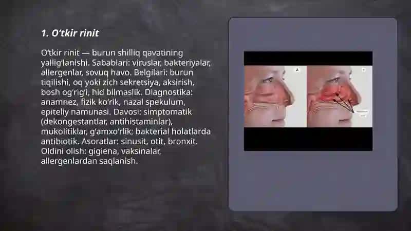Burun va uning yondosh boʻshligʻi kasalliklari 3