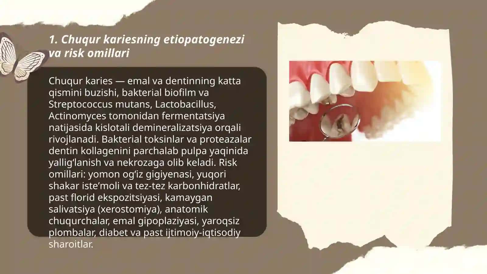 Chuqur karies tashxislash, tasnifi, klinik kechishi, davolash 3