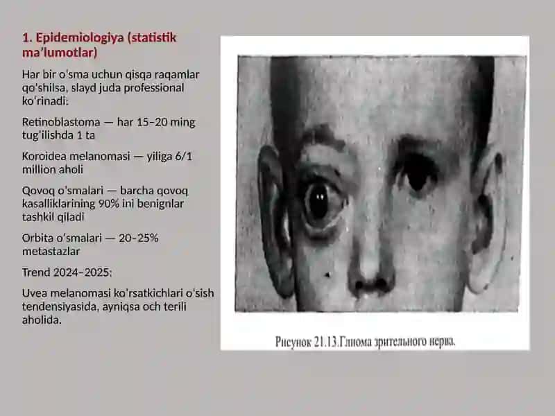 Onkooftalmologiya 3