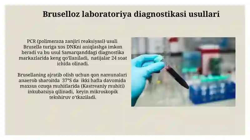 Bruselloz laboratoriya diagnostikasi usullari 3