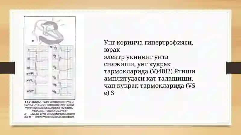 YURAK NUQSONLARIDA XAQIDA TUSHUNCHA  EKG OʻZGARISHLARNI ANIQLASH 3